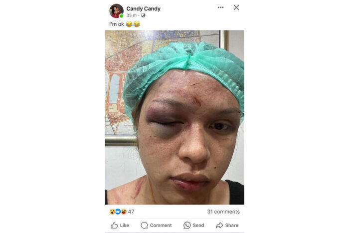 Trans woman assault